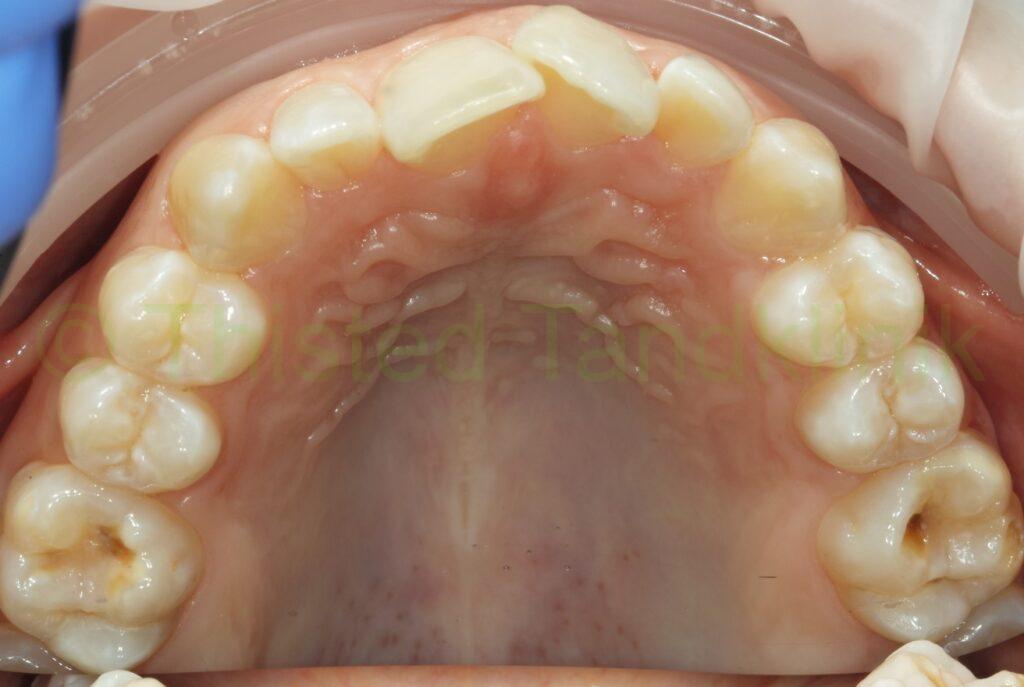 Eks-01: OK – inden – Thisted Tandklinik